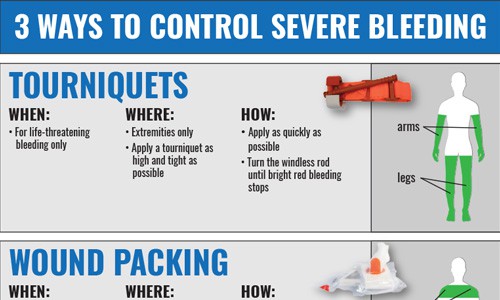 3-Ways-to-Control-Severe-Bleeding